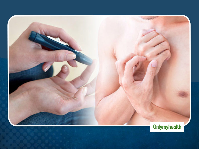 Diabetes Warning Signs: त्‍वचा पर इन 6 तरीकों से दिख सकते हैं डायबिटीज के चेतावनी संकेत